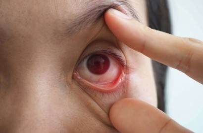 Glaucoma: entenda a condição que atingiu o cantor Marrone